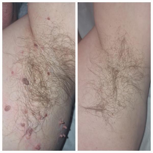 Imogen's Laser Skin Clinic- Hair Removal and Skin Specialists